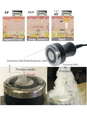RFU 3D smas Ultrasuoni Focalizzato + Radiofrequenza