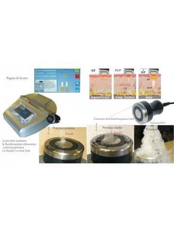 RFU 3D smas Ultrasuoni Focalizzato + Radiofrequenza